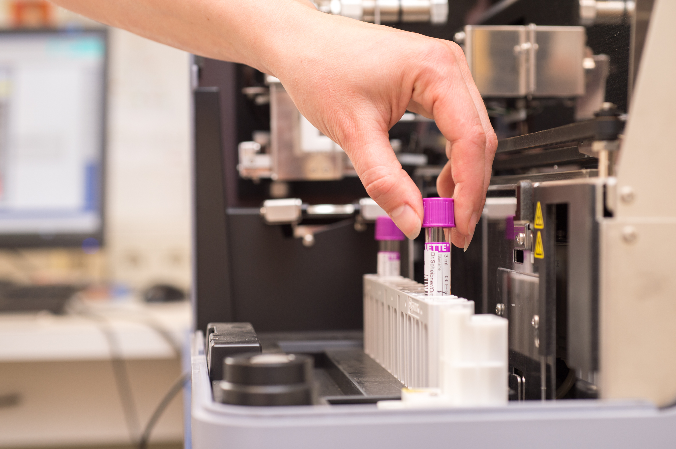 Umfangreiche Labordiagnostik